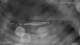 Ostseebad Binz 04.07.2025 01:51