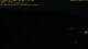 Altena 09.06.2025 03:31