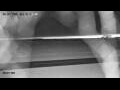 Webcam Norden