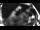 Webcam in Badenweiler, 11.9 mi away