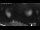 Webcam in Ehrwald, 7.7 km entfernt