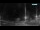 Webcam on Corfu, 21.5 mi away