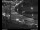 Webcam in Dresden, 0.9 mi away