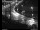 Webcam in Dresden, 1.5 mi away