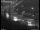 Webcam in Dresden, 7.4 mi away