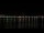 Webcam in Bordeaux, 1.4 mi away