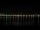 Webcam in Bordeaux, 0 km entfernt