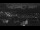 Webcam in Clermont-Ferrand, 6 mi away