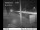 Webcam in Easton, Washington, 88.7 km