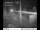 Webcam in Easton, Washington, 20.8 mi away