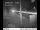 Webcam in Easton, Washington, 104.7 km entfernt