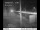 Webcam in Easton, Washington, 230.8 km entfernt