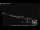 Webcam in Nuuk, 85.8 km