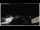 Webcam in Sant'Eusanio, 20.8 mi away