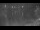 Webcam in Les Anses-d'Arlet, 48.3 km