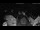 Webcam in Obervellach, 3 km entfernt