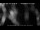 Webcam in Kanzoni, 359.8 km