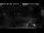 Webcam in Kanzoni, 758.5 km