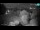 Webcam in Kamnica, 9.6 mi away