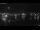 Webcam in Juelsminde, 34.2 mi away