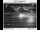Webcam in Sunnyside, Oregon, 65.9 km
