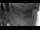 Webcam in Millersburg, Pennsylvania, 28.6 km