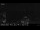 Webcam in Leogang, 4.9 km entfernt