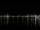 Webcam in Bordeaux, 0 mi away