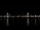 Webcam in Bordeaux, 0 mi away
