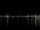 Webcam in Bordeaux, 0 mi away