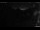 Webcam in Zermatt, 1.7 km