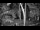 Webcam in Pustkowo, 5.5 mi away