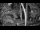 Webcam in Pustkowo, 5.5 mi away