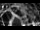 Webcam in Osiek, 18.6 mi away