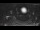 Webcam in Au-Schoppernau, 1.7 mi away