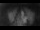 Webcam in Jork, 1.9 mi away