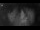 Webcam in Jork, 5.1 mi away
