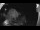 Webcam in Klingenthal, 12.3 mi away