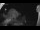 Webcam in Klingenthal, 15.6 km