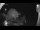 Webcam in Klingenthal, 6 mi away