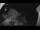 Webcam in Klingenthal, 6 mi away
