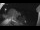 Webcam in Klingenthal, 4 km