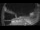 Webcam on the Ivalo Arctica, 27 mi away