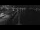 Webcam on the AIDAperla, 0.6 mi away