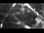 Webcam in Miami, Florida, 38.6 mi away