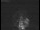 Webcam at the Jodrell Bank Observatory, 25.6 mi away