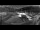 Webcam in Antholz, 1.9 mi away