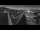 Webcam at mount Petzen, 8.1 mi away