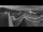 Webcam at mount Petzen, 8.1 mi away