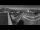Webcam at mount Petzen, 1.9 mi away
